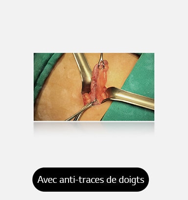 L’image de droite, avec un revêtement anti-traces de doigts, sans taches, offre une meilleure vue de la zone chirurgicale.