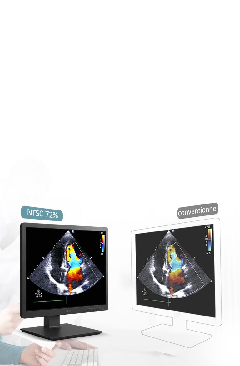 330 nits et résolution précise NTSC 72%2