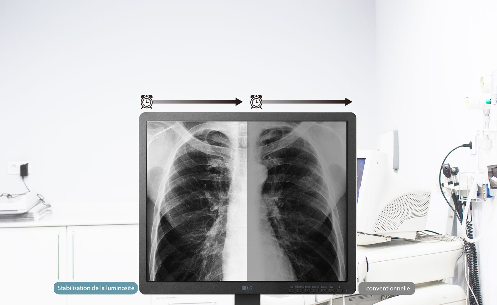 Stabilisation de la luminosité1