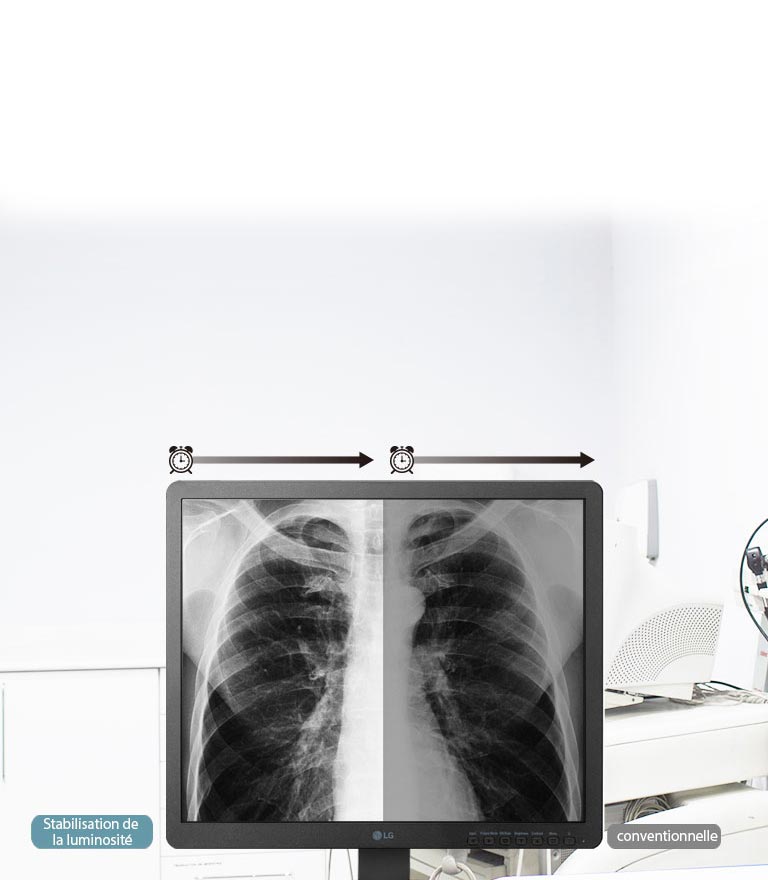 Stabilisation de la luminosité2