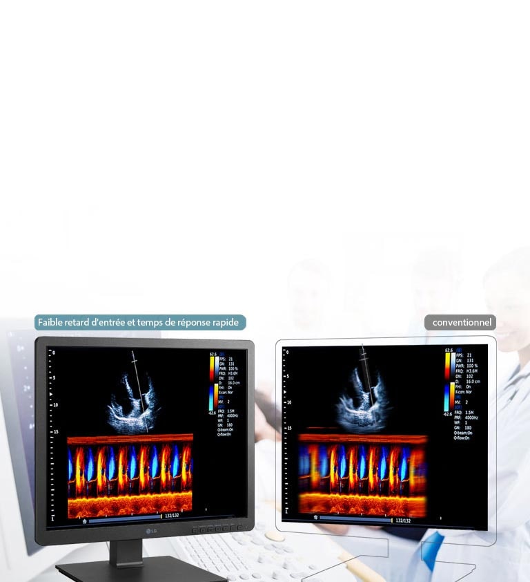 Temps de réponse rapide2