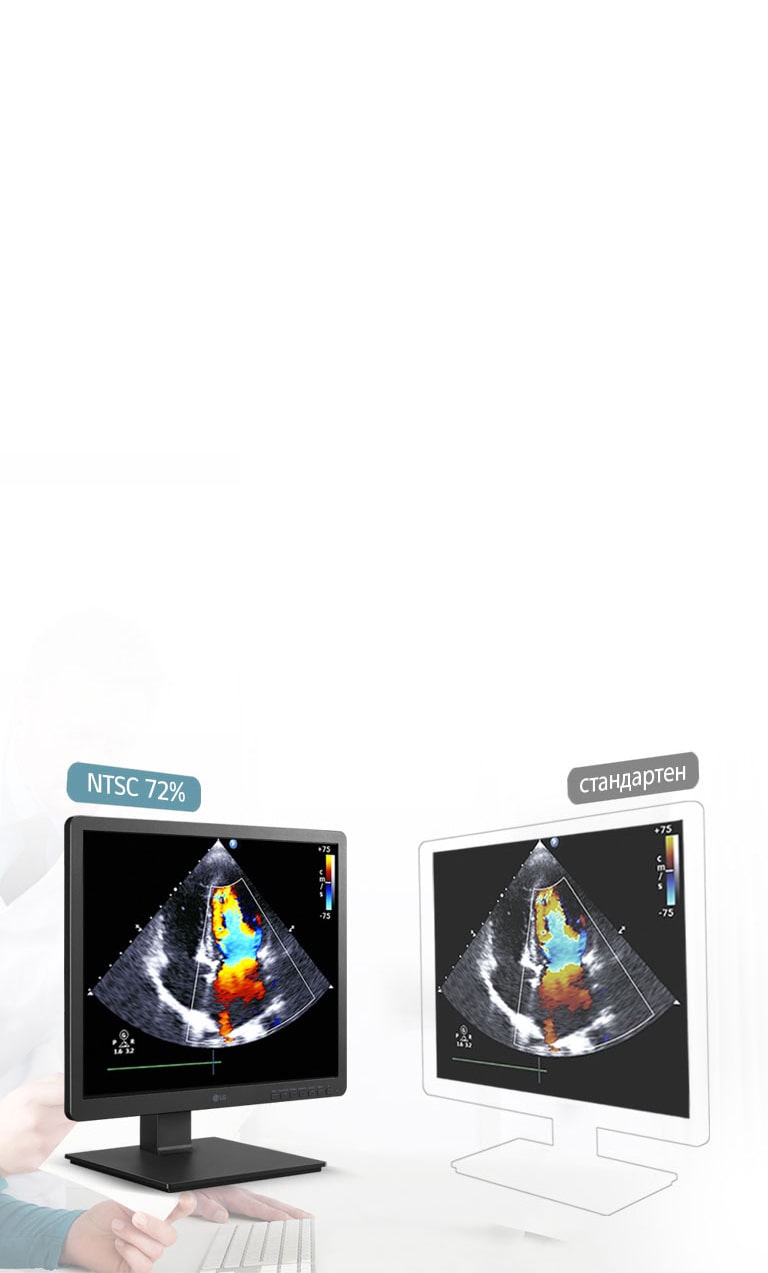 Прецизна резолюция с 330 нита и NTSC 72Ŵ