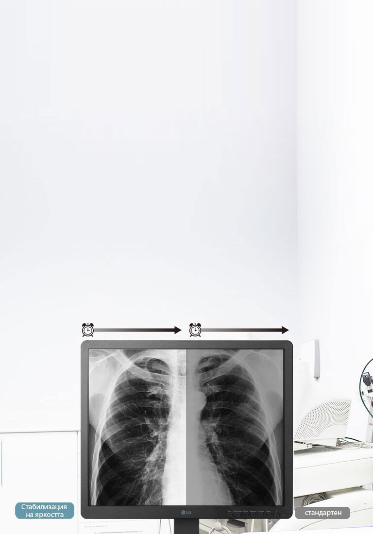 Стабилизация на яркостта2