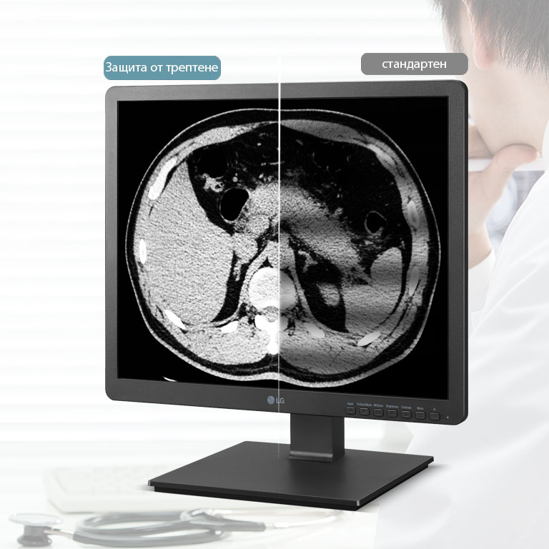 Защита от трептене2