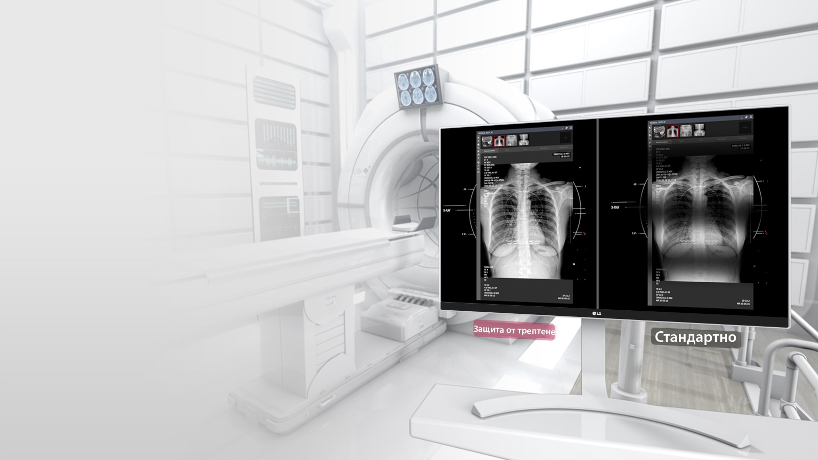 Защита от трептене1