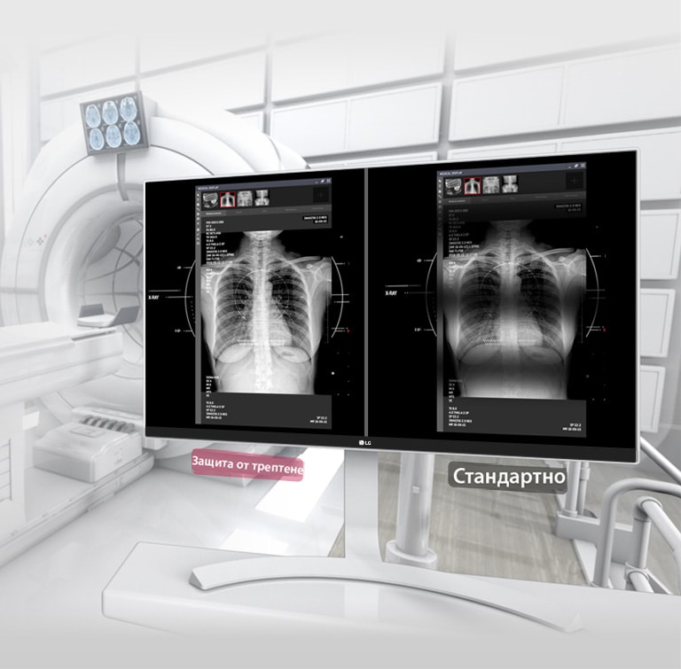 Защита от трептене2