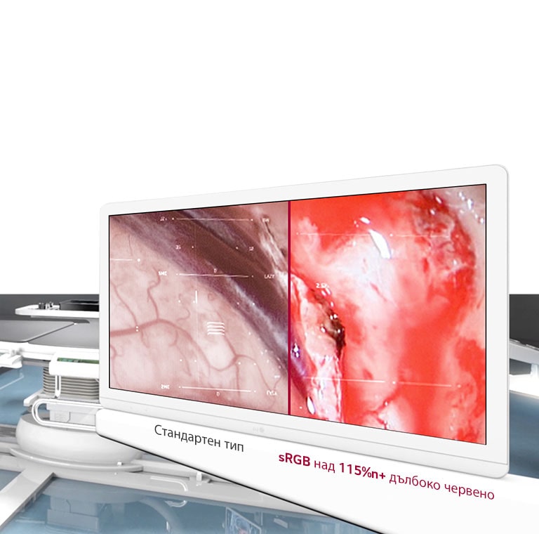 Оптимално качество на изображението2