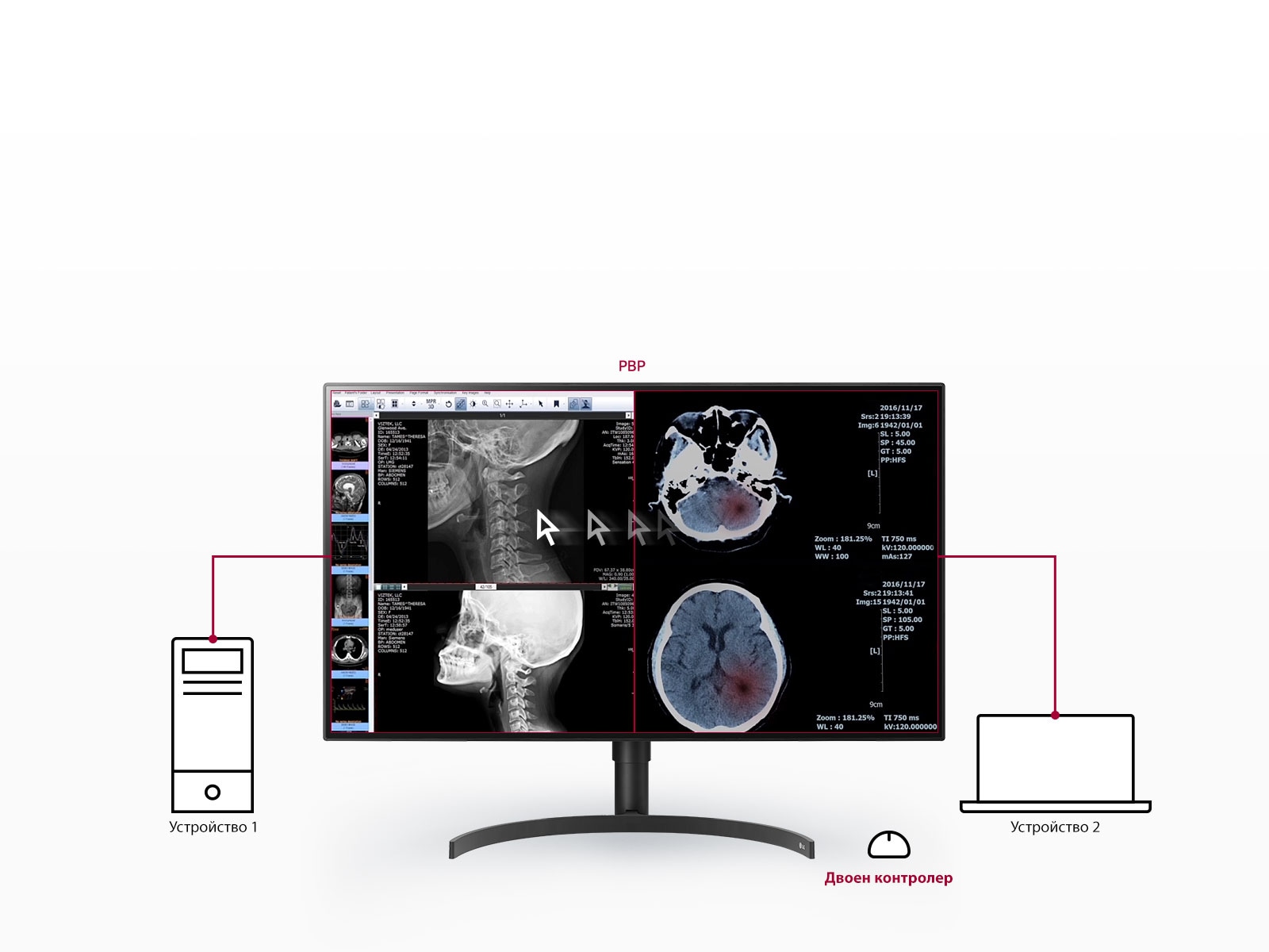 Множество сигнали на един екран