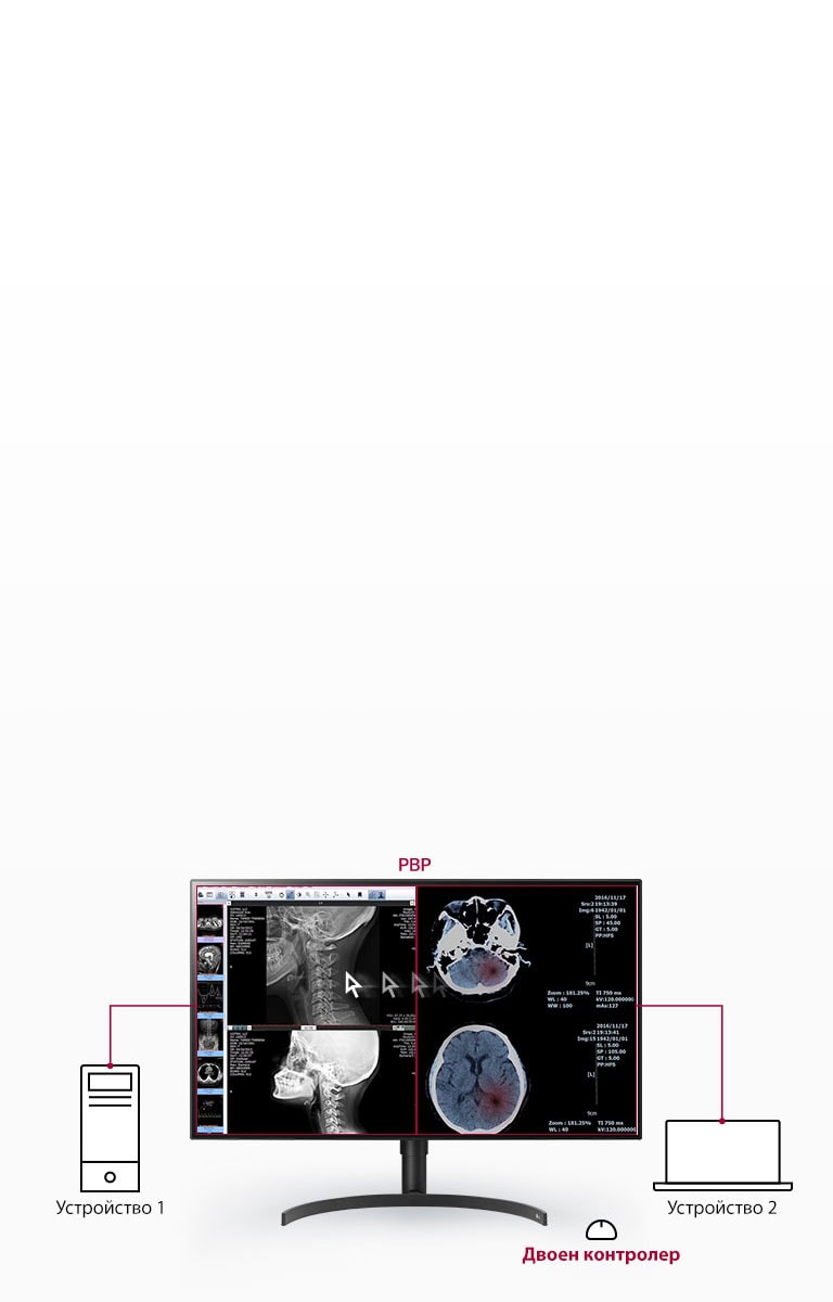Множество сигнали на един екран