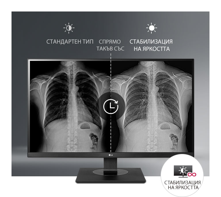 Съгласувано стабилно показване2