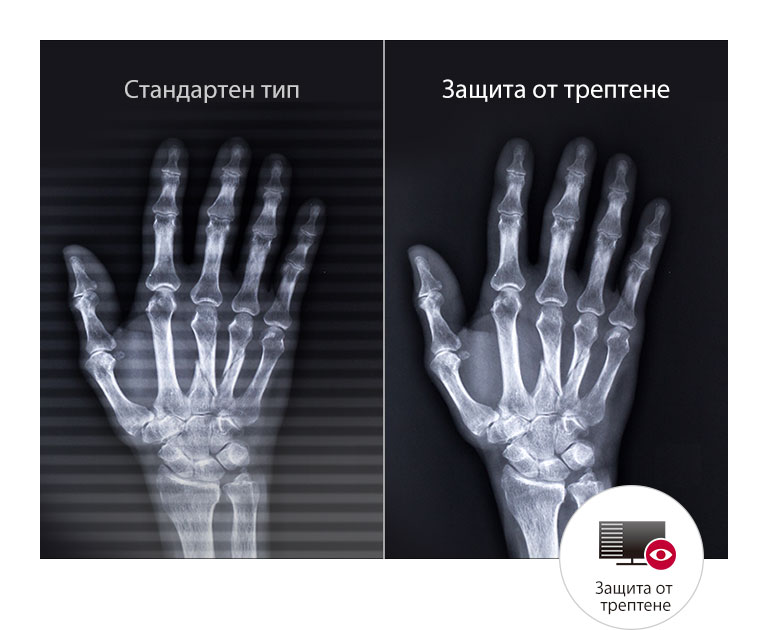 Дълготраен комфорт за очите2