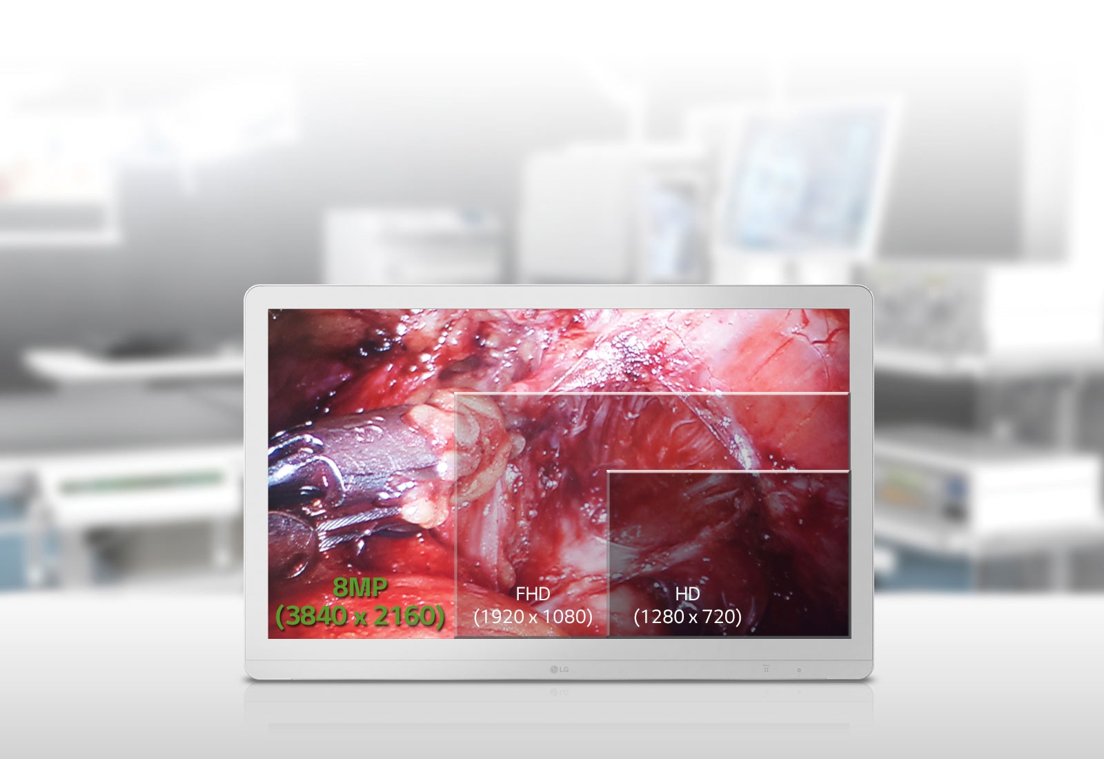 27" IPS 8MP UHD първокласен дисплей 1