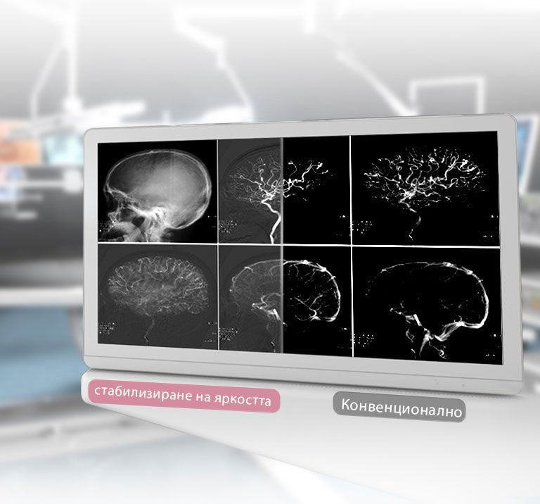 DICOM част 14 и стабилизиране на яркостта 2