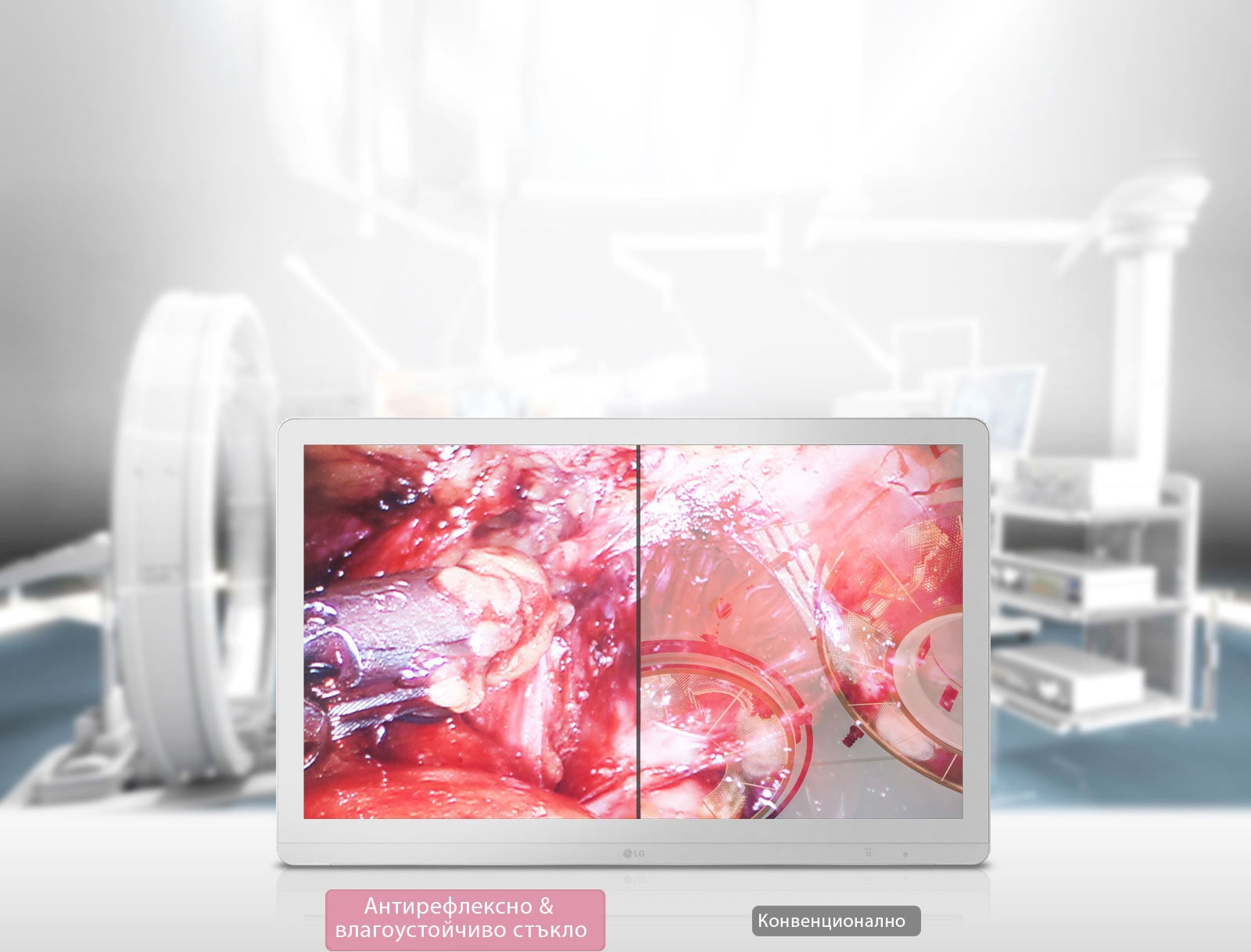 Антирефлексно, влагоустойчиво стъкло1