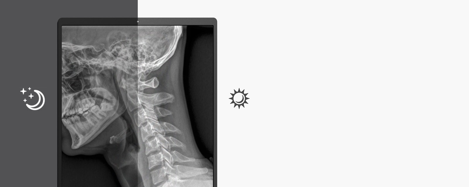 сензор за автоматичната осветеност, който предлага автоматично регулиране на яркостта на екрана на оптималното ниво в зависимост от околното осветление