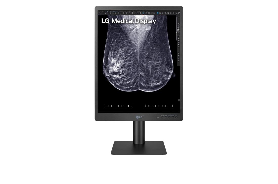 LG 21,3-инчов 5MP IPS диагностичен монитор за мамография, изглед отпред, 21HQ613D-B