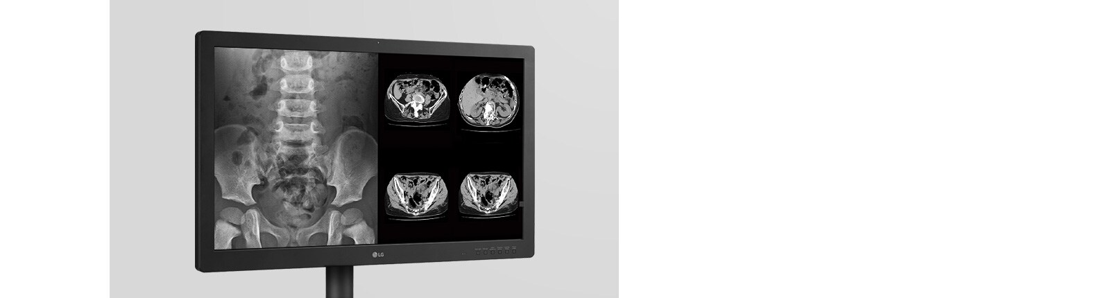 Надеждно изображение за прецизна диагностика