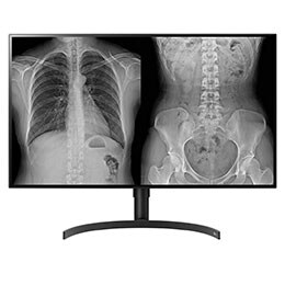 LG 31,5'' UHD Диагностичен монитор2