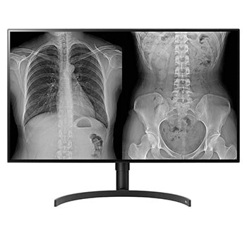 LG 31,5'' UHD Диагностичен монитор1