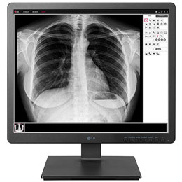 LG 19'' SXGA Монитор за образна диагностика 2