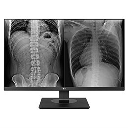 LG 27'' UHD Монитор за образна диагностика2