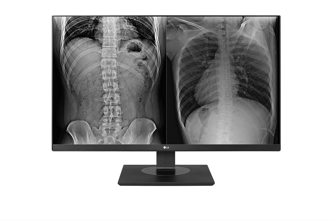 LG 27'' UHD Монитор за образна диагностика, 27HJ713C-B