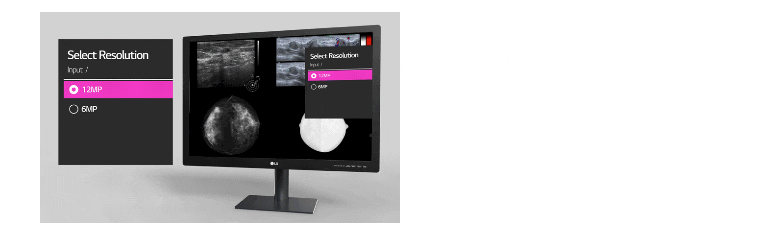 режим „Мулти-разделителна способност“, който предлага на потребителите възможност за избор на разделителна способност между входни стойности 12 MP и 6 MP