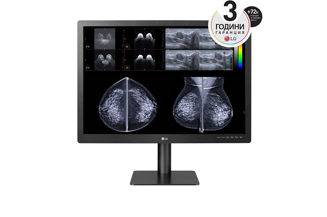 LG 31-инчов 12-мегапикселов диагностичен монитор за мамография, изглед отпред, 31HN713D-BA, thumbnail 8
