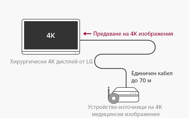 Поддръжка на 12G-SDI: Хирургическият 4K дисплей от LG дава възможност за предаване на 4K сигнали на дълги разстояния по единичен коаксиален кабел без забавяне, за да осигури стабилна хирургична работа.