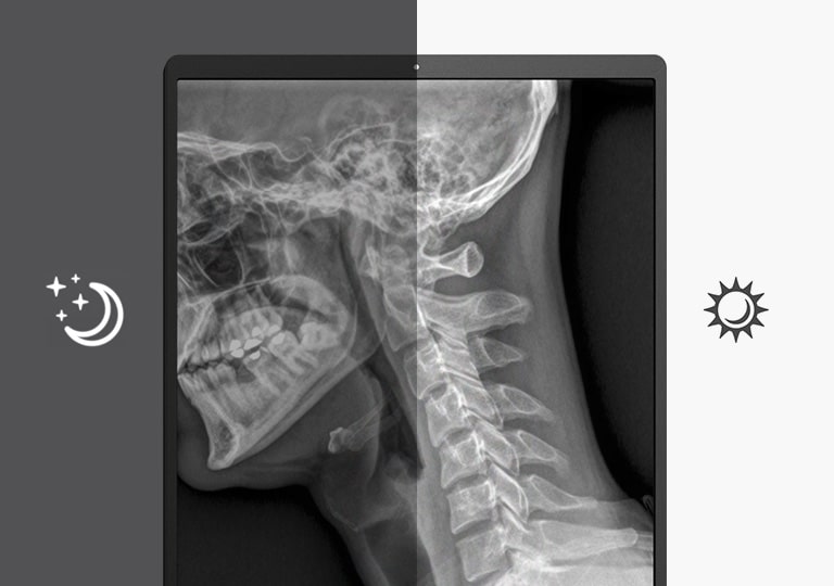 сензор за автоматичната осветеност, който предлага автоматично регулиране на яркостта на екрана на оптималното ниво в зависимост от околното осветление