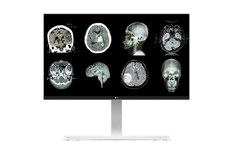 LG 27'' UHD Медицински монитор, 27HJ712C-W, thumbnail 1