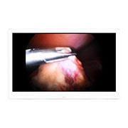 LG 27” Monitor Cirúrgico LG IPS 4K (8MP), 27HJ710S, thumbnail 2