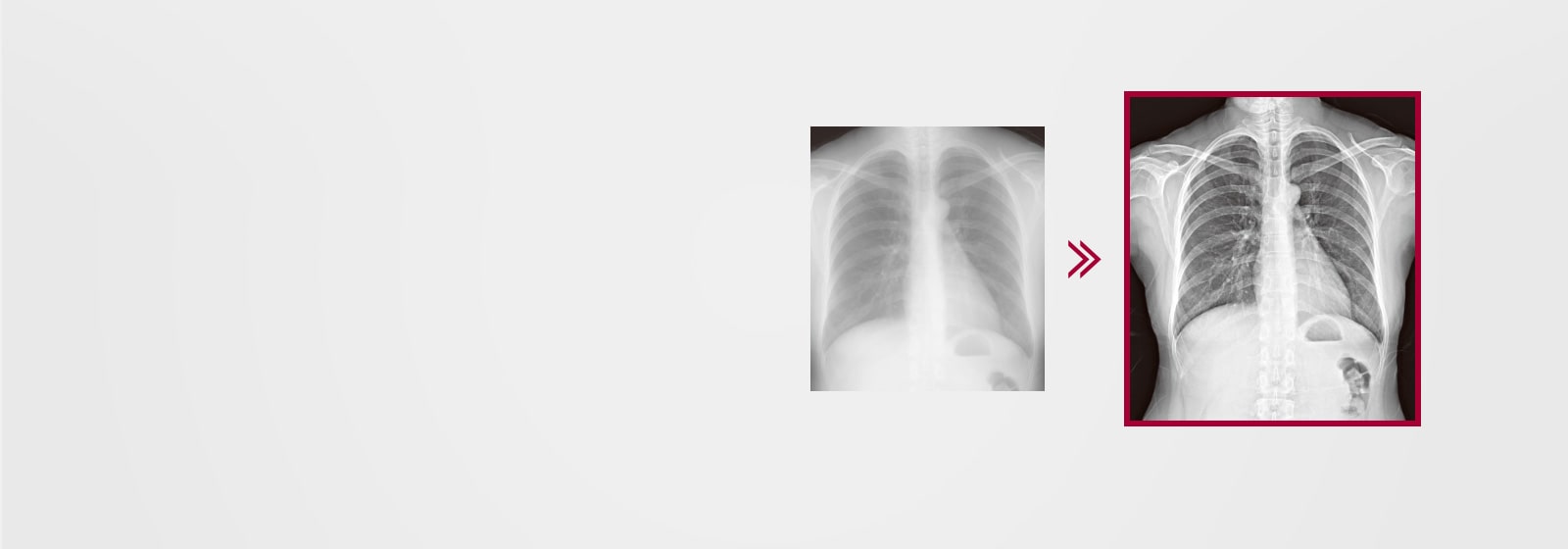El resultado es una imagen más detallada usando el procesamiento de imagen de múltiples capas integrado en el AWS, comparado con el resultado de la imagen sin procesamiento de imagen de múltiples capas