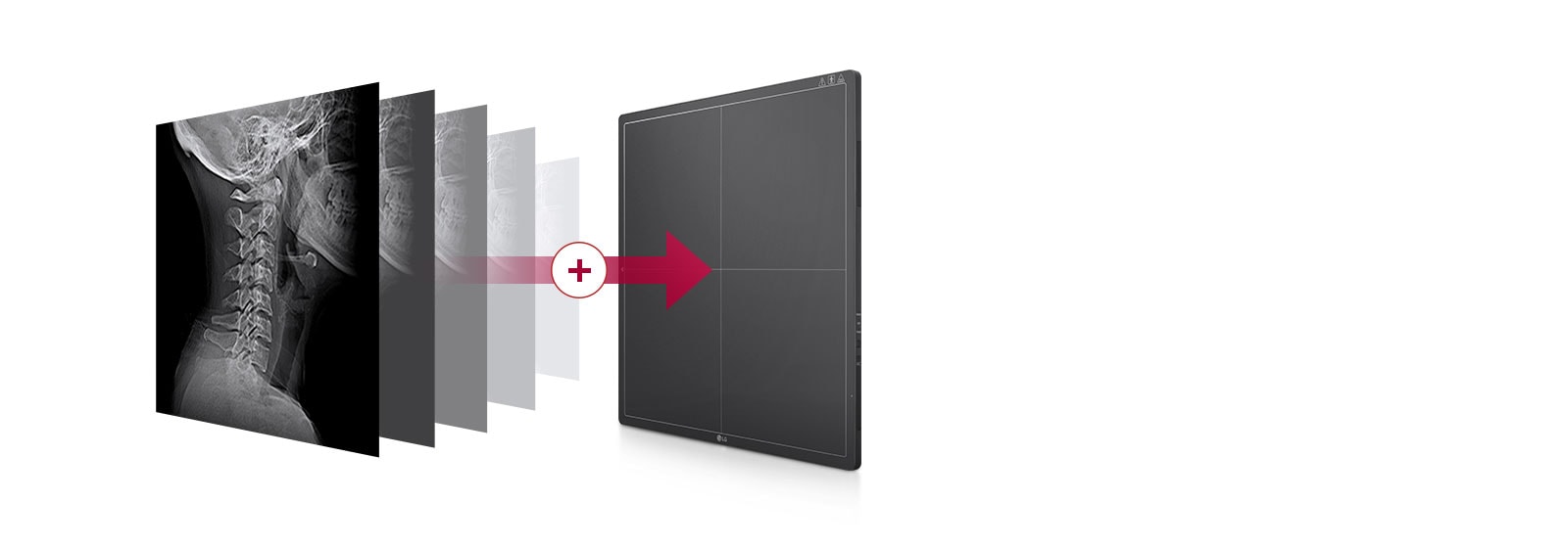 Una memoria incorporada que almacena automáticamente las imágenes tomadas en el detector, hasta 200 imágenes