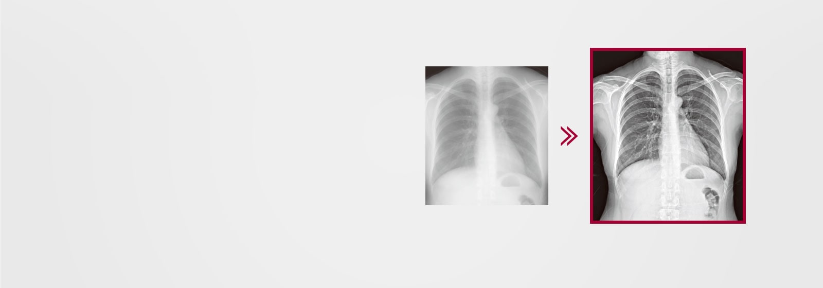 El resultado es una imagen más detallada usando el procesamiento de imagen de múltiples capas integrado en el AWS, comparado con el resultado de la imagen sin procesamiento de imagen de múltiples capas