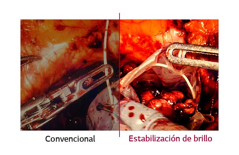 Estabilización de brillo2