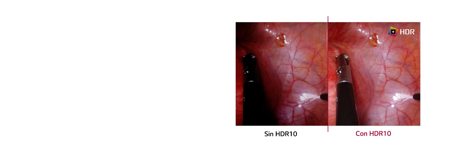 Sin HDR10 comparado con HDR10