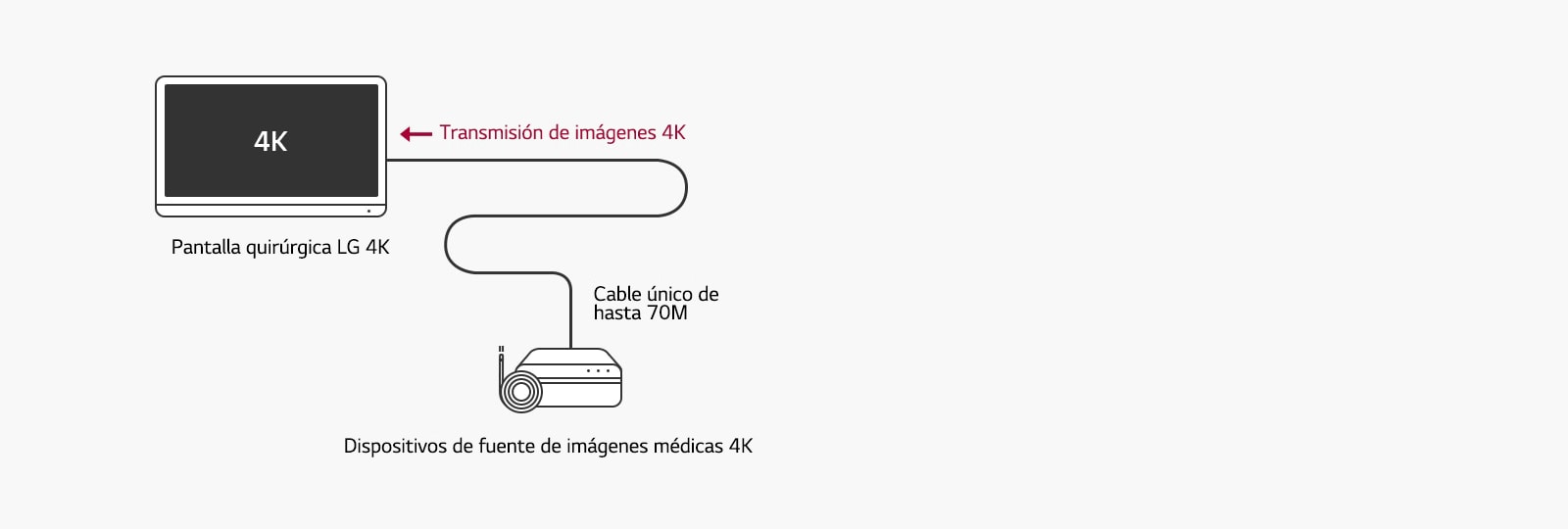 Soporte 12G-SDI: La pantalla quirúrgica 4K de LG permite la transmisión a larga distancia de señales 4K a través de un único cable coaxial sin retrasos para una cirugía estable.