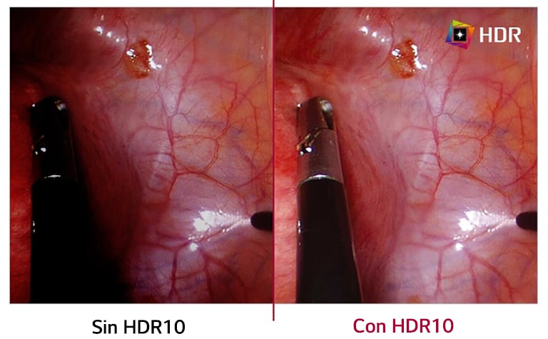 Sin HDR10 comparado con HDR10