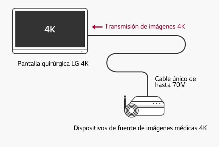 Soporte 12G-SDI: La pantalla quirúrgica 4K de LG permite la transmisión a larga distancia de señales 4K a través de un único cable coaxial sin retrasos para una cirugía estable.