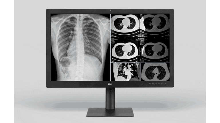 Centrarse plenamente en la región de interés