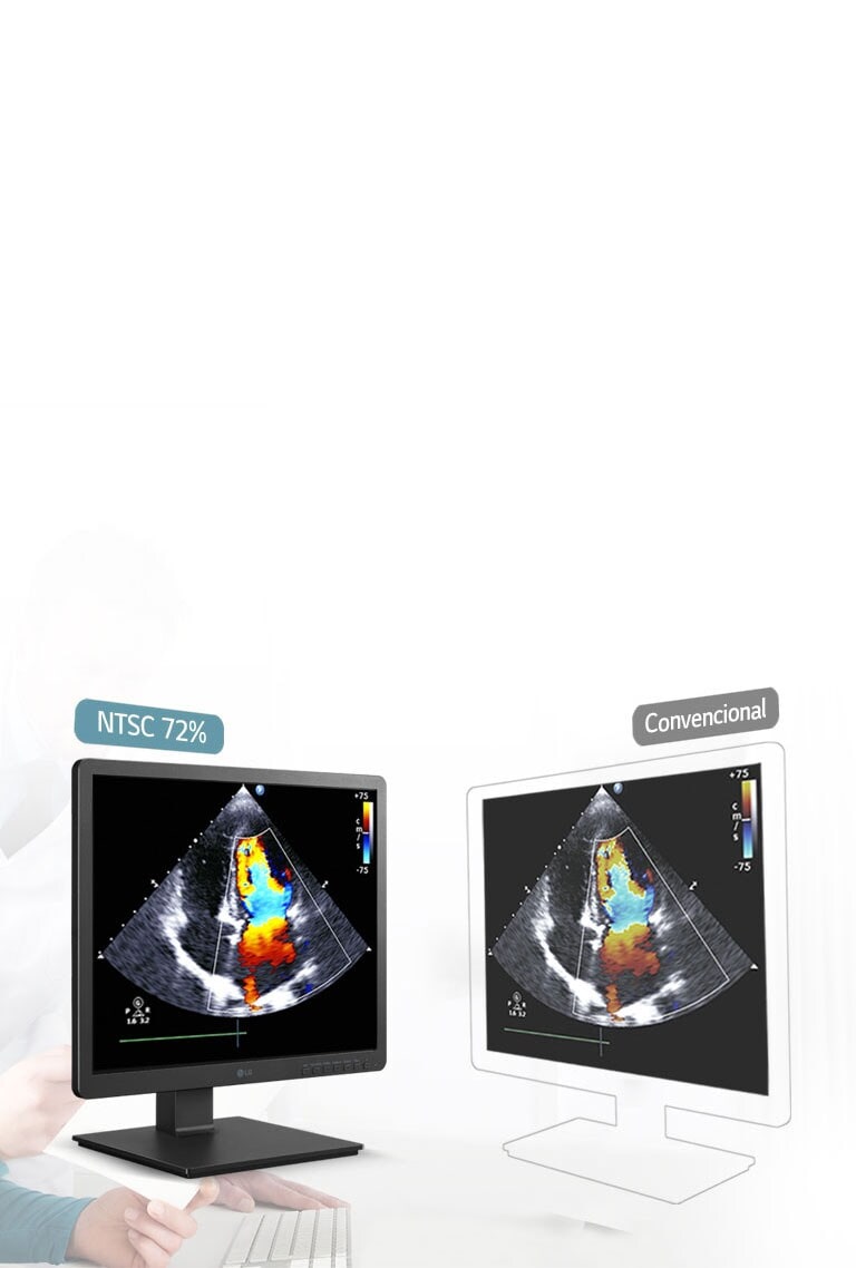 Resolución precisa de 330nits y NTSC 72%
