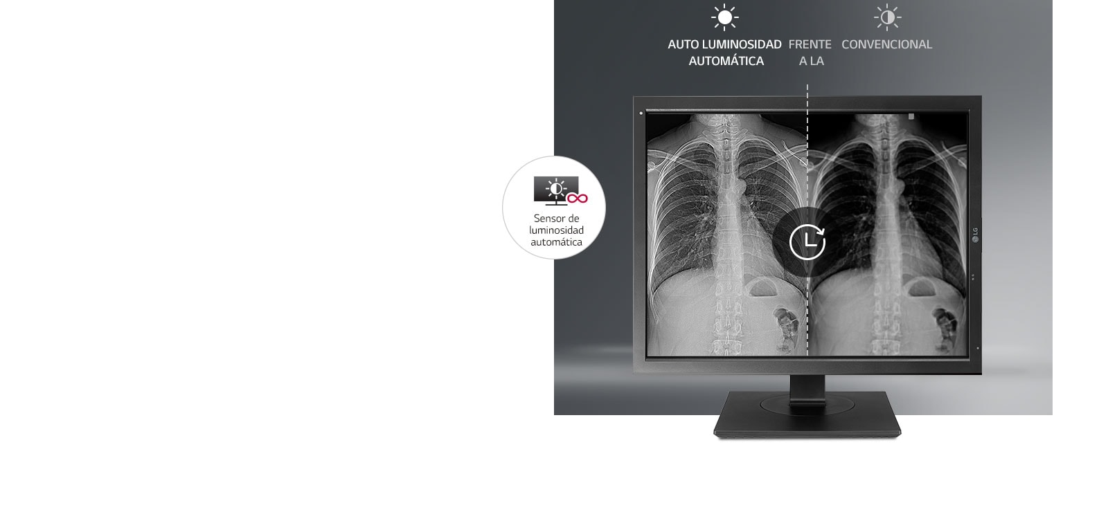 Estabilización de brillo automática