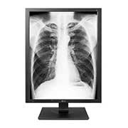 LG Monitor de diagnóstico LG de 3MP, Front view, 21HQ513D-S, thumbnail 1