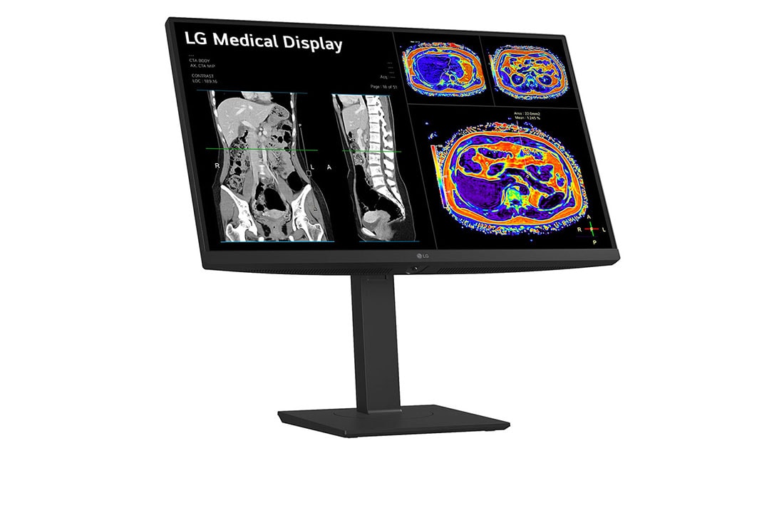 LG Monitor de revisión clínica 27'', Panel IPS, 8MP, sensor de calibración desmontable, 178º Ángulo de Visión, levi bočni prikaz, 27HS713C-B, thumbnail 6