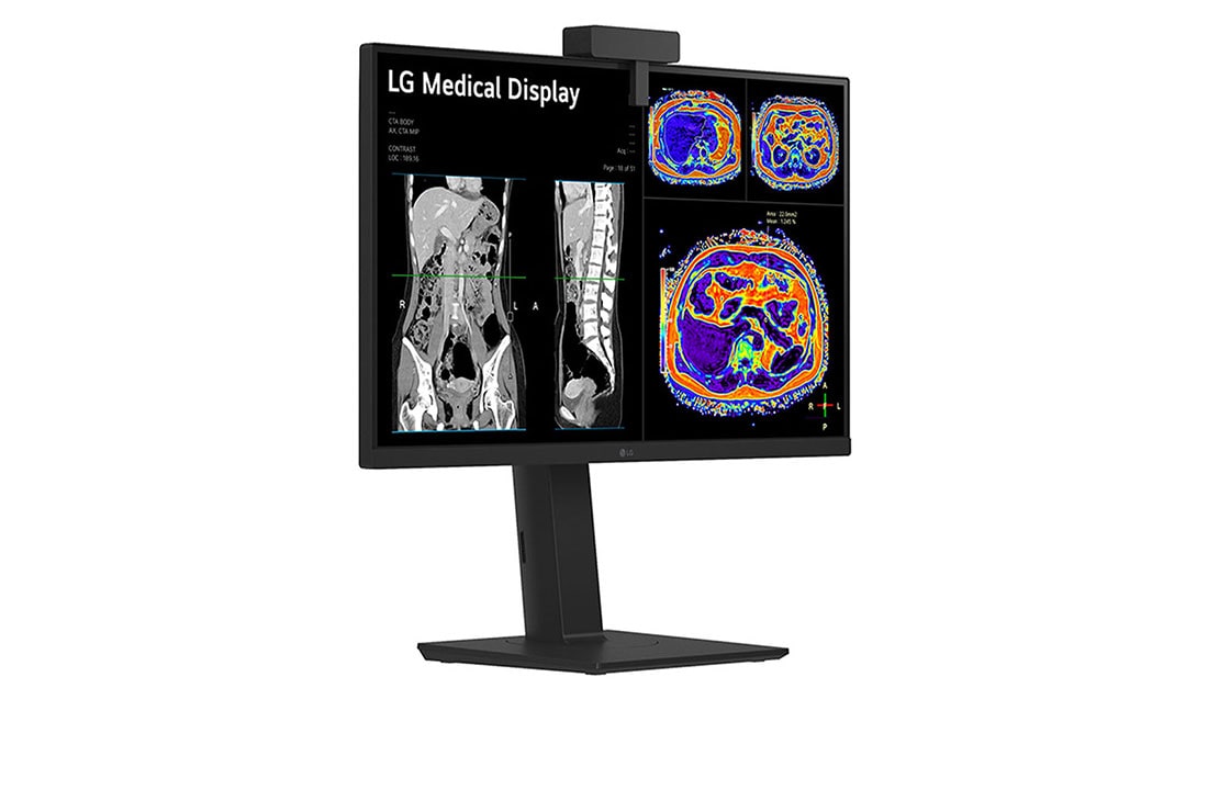 LG Monitor de revisión clínica 27'', Panel IPS, 8MP, sensor de calibración desmontable, 178º Ángulo de Visión, prednji prikaz sa senzorom za kalibraciju, 27HS713C-B, thumbnail 14