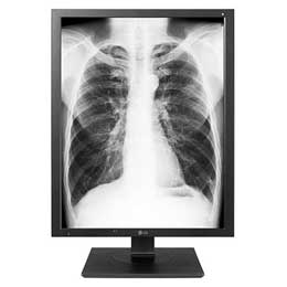 Monitor Quirúrgico Full HD 2