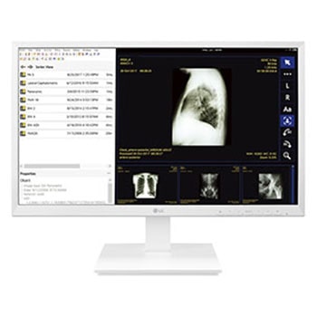 Monitor Zero Client 24" Thin Client Todo-en-Uno para Cuidado de la Salud1