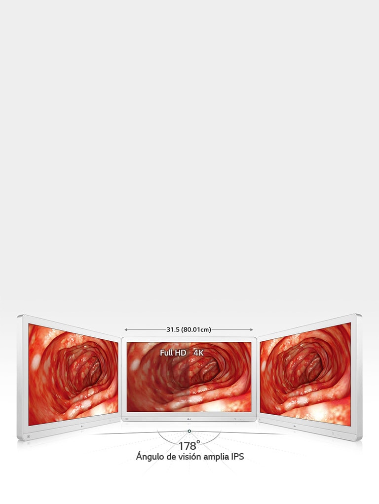 Mayor precisión con visión amplia2