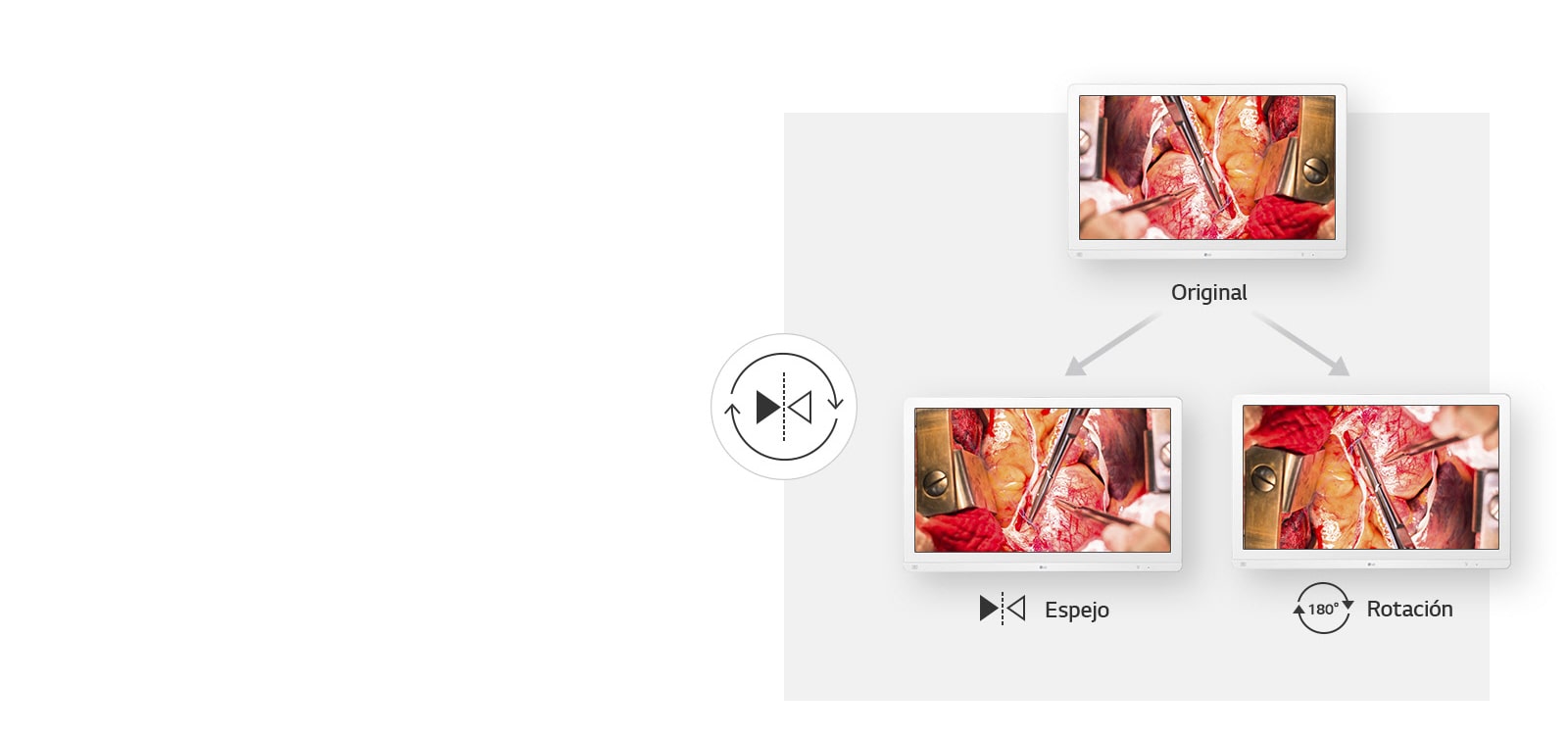 Encuentra la visión perfecta para operar1